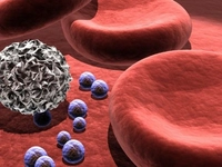 Lenfoma Tipleri Nelerdir?